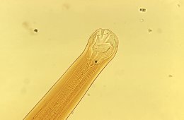 Hookworm (Ancylostoma braziliense mouth parts)