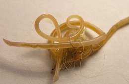Roundworm (Toxocara cati)