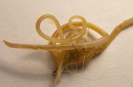 Roundworms from the gut