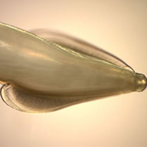 Cat roundworm (Toxocara cati)